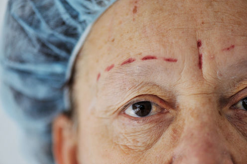 Safety before profits: why cosmetic surgery is ripe for regulation