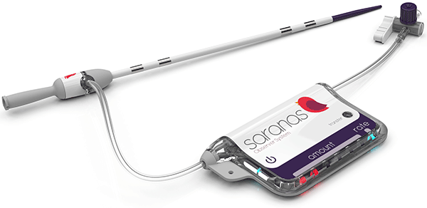 Saranas SOS System Warns of Bleeding During Cath Lab Procedures