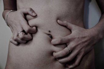 Bodies come in all sizes – and so do eating disorders