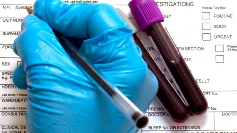 New Blood Test Can Reveal Every Virus You’ve Ever Been Infected With