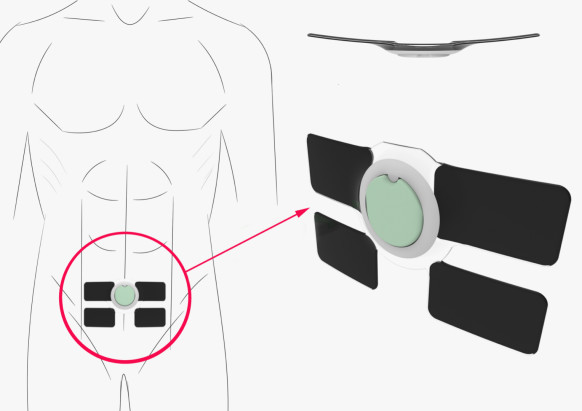 A Life-Changing Wearable That Tells People When to Pee