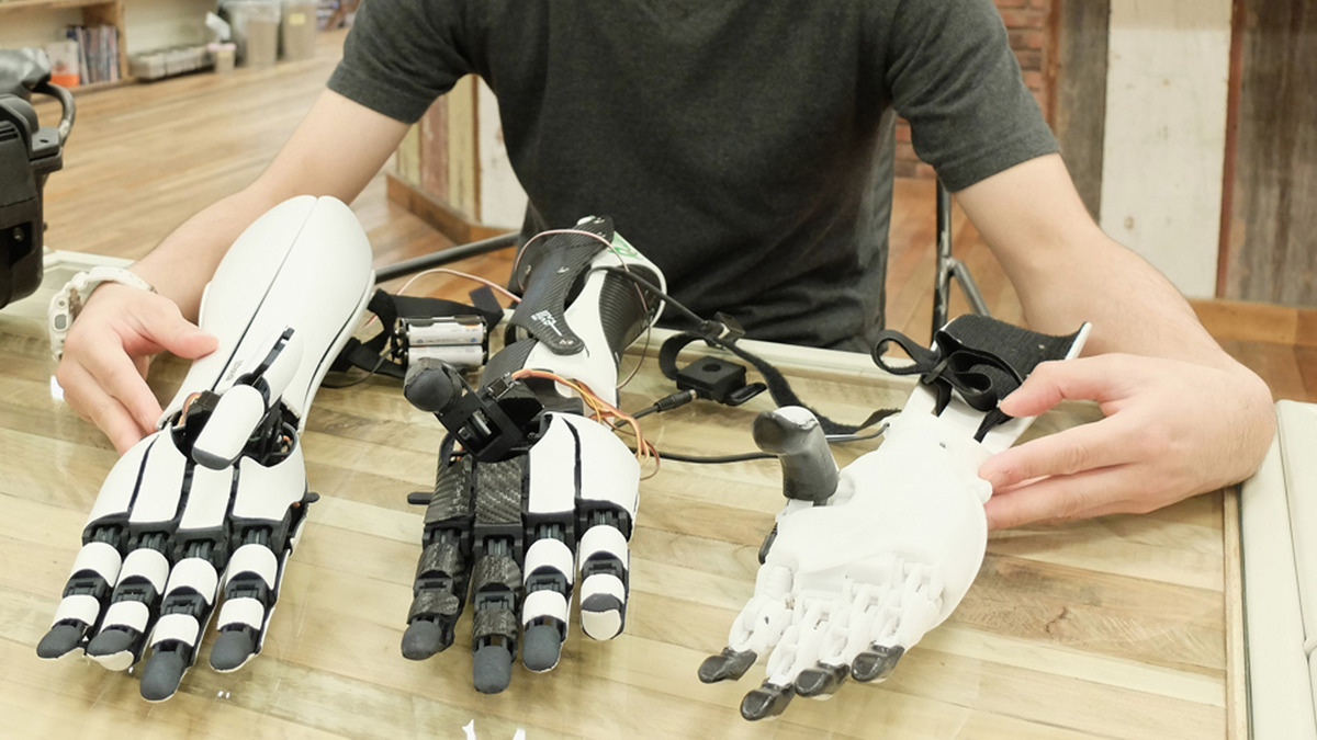 Prosthetic arms