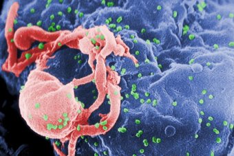 French teen born with HIV in remission for 12 years: researchers