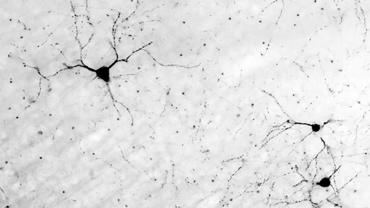 Neurons