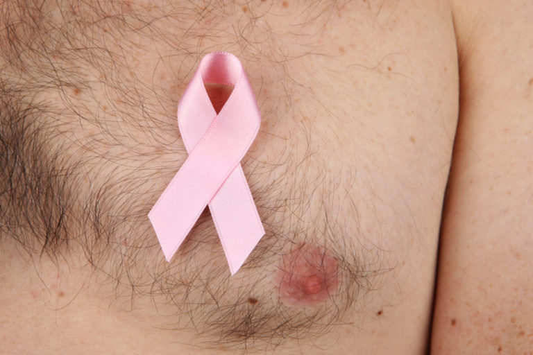 What men need to know about breast cancer