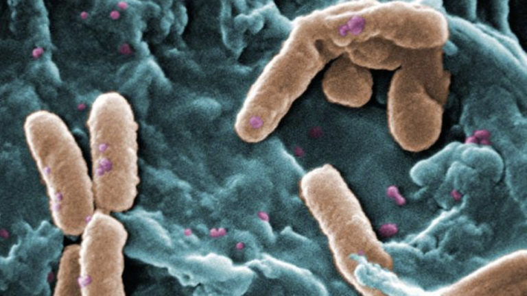 Bacteria resistant to antibiotics may be deadlier and harder to treat