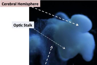 Researchers grow first fully formed brain in laboratory