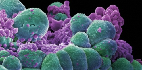 Scientists Say It May Be Feasible To ‘Reprogram’ Cancer Cells Back To Normal