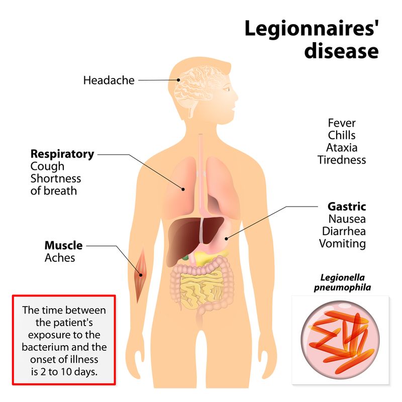 legionnaires outbreak 1