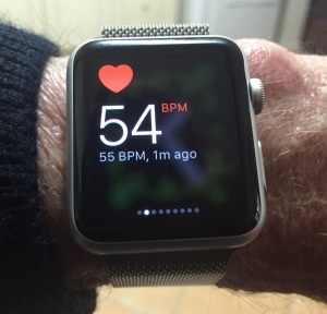 Apple Watch saves Aussie tech journo’s life