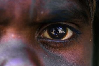 32,000 Indigenous Australians likely to be blind by 2025: report