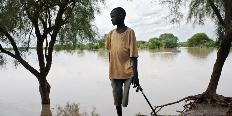 Snake bites leave an estimated 400,000 people with permanent disability each year. The boy pictured above, from South Sudan, had to undergo a leg amputation due to lack of access to care after being bitten by a snake.