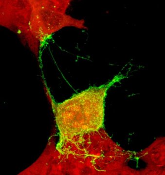 Study blocks ebola virus budding by regulating calcium signaling