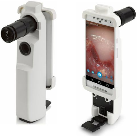 MobileODT Brings Cervical Cancer Diagnostics to Remote Places