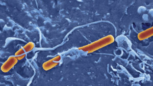 shigella_drug-resistant-bacteria-1.jpg