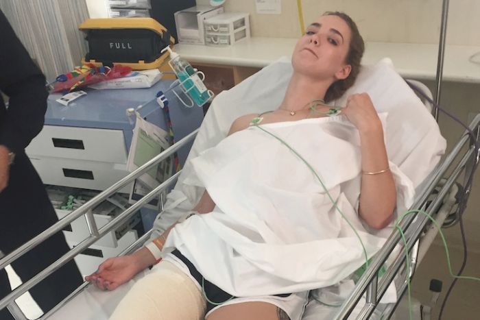 Perth woman bitten by tiger snake suffers rare delayed reaction