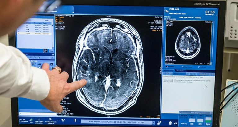 Scientists Break Through Blood-Brain Barrier To Treat Cancer Patient, Making Medical History