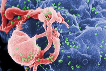 HIV and AIDS: Where are we now?