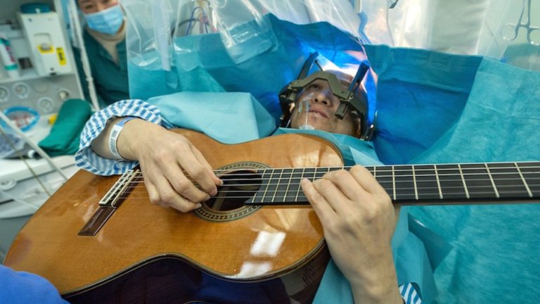 Chinese musician plays the guitar while undergoing brain surgery