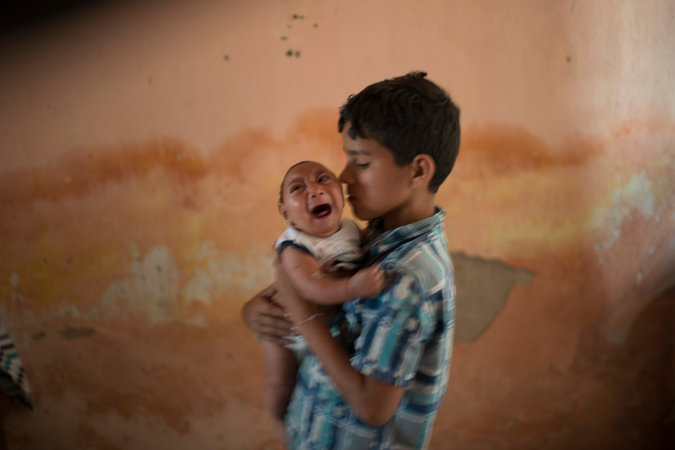 Above, a child consoles his sibling who was born with microcephaly linked to Zika infection during prenatal development. 