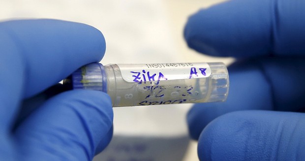 Texas Reports First Case Of Sexually Transmitted Zika Virus In U.S.