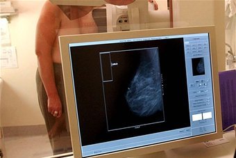 Hope for new treatment for women with breast cancer gene