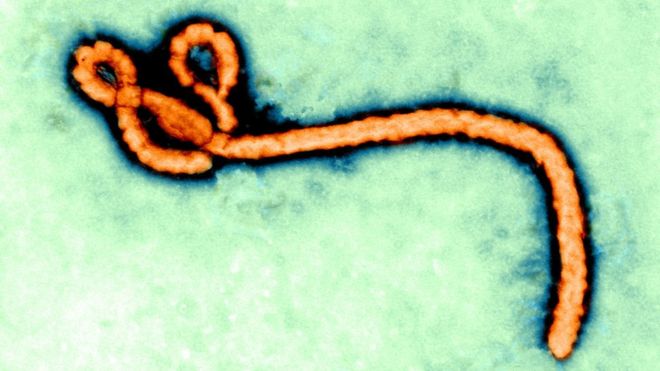 90156559_c0282948-ebola_virus_tem-spl.jpg