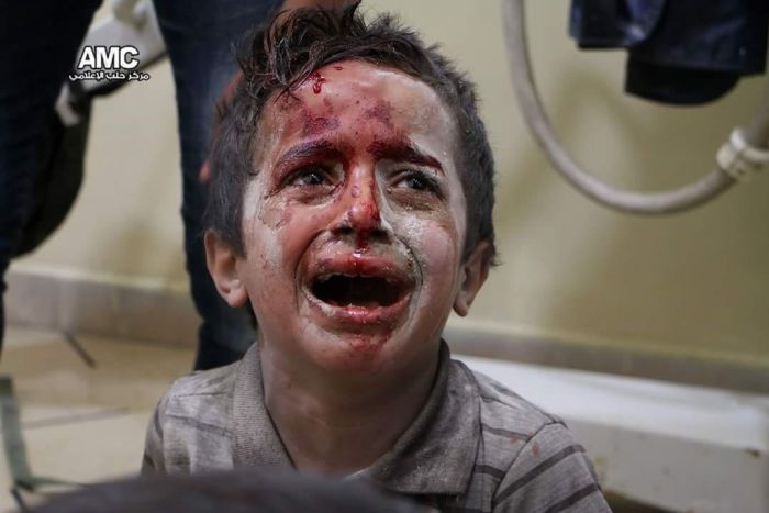 Photo: A bloodied boy waits for treatment at a hospital in Aleppo (Supplied: Aleppo Media Centre)