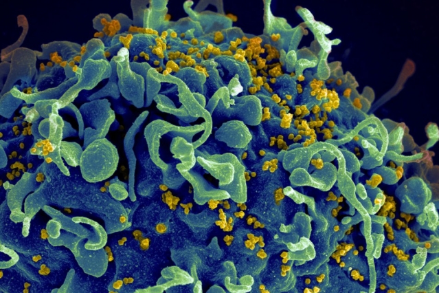 HIV ‘safe houses’ identified inside the body